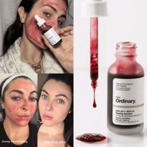 The Ordinary AHA 30%+ BHA 2% Peeling Solution 30ml