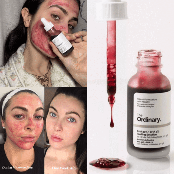 The Ordinary AHA 30%+ BHA 2% Peeling Solution 30ml