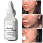 The Ordinary Niacinamide 10% + Zinc 1% Serum 30ml