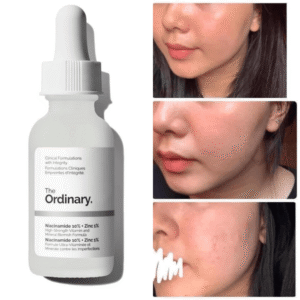 The Ordinary Niacinamide 10% + Zinc 1% Serum 30ml
